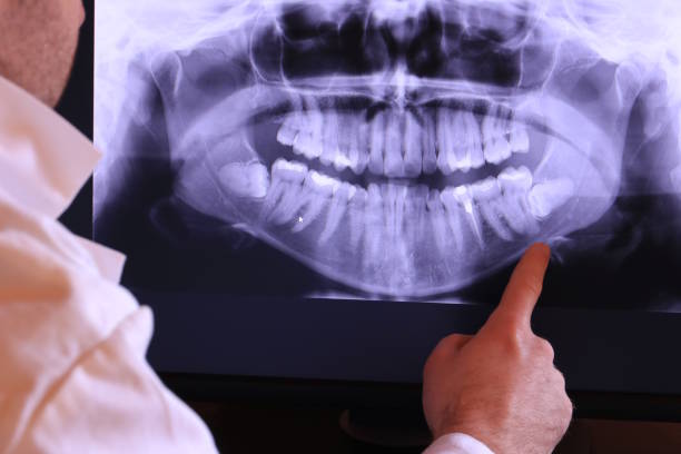 Best Emergency Dental Extractions in Driggs, ID